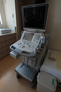 腹部超音波診断装置